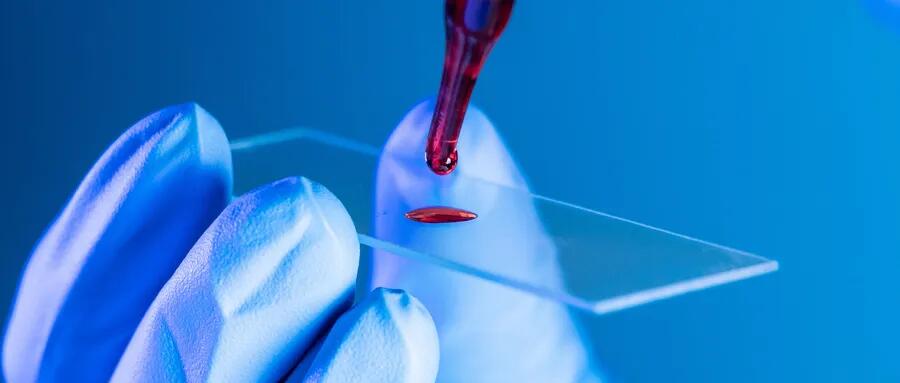 【原創(chuàng)研究】血液制品行業(yè)投研報告之二:國內(nèi)企業(yè)分離提純工藝仍有較大提升空間